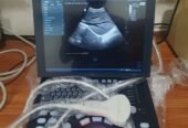 Mindray Brand New Ultrasound machines . PW Doppler,Tilting Screen