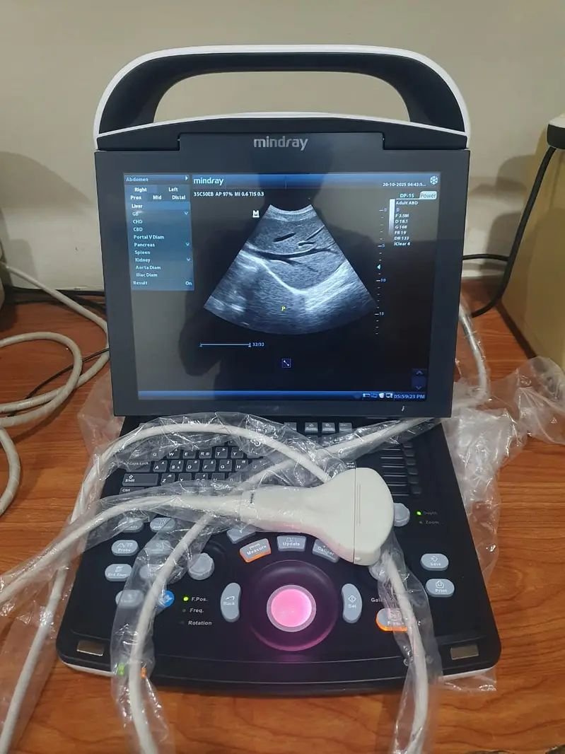 Mindray Brand New Ultrasound machines . PW Doppler,Tilting Screen