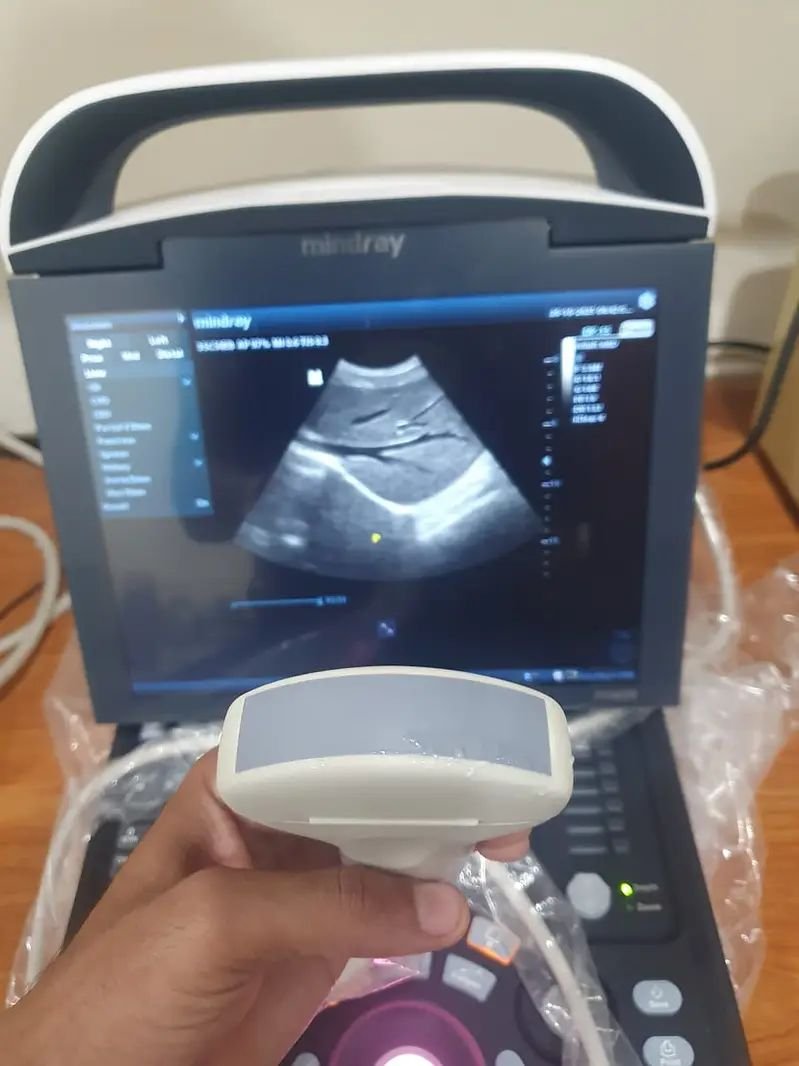 Mindray Brand New Ultrasound machines . PW Doppler,Tilting Screen